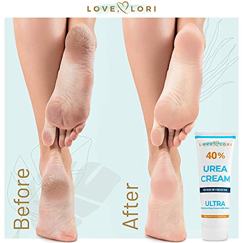 Urea Cream 40 Percent for Feet 4 oz by Love Lori - Foot Cream For Dry Cracked...