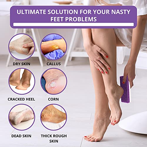 Love Natural Pumice Stone for Feet - Ultimate 2-in-1 Scrubber and Professiona...