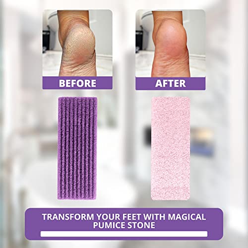 Love Natural Pumice Stone for Feet - Ultimate 2-in-1 Scrubber and Professiona...