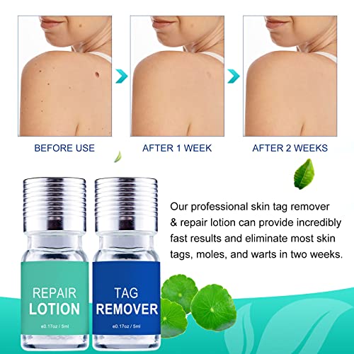 Skin Tag Remover, Wart & Mole Remover, Natural Plant Extracts, Easy to Apply,...