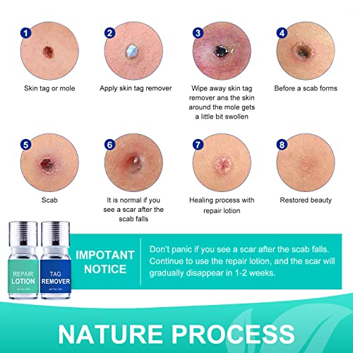 Skin Tag Remover, Wart & Mole Remover, Natural Plant Extracts, Easy to Apply,...