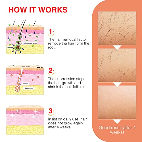 Hair Growth Inhibitor Spray, Hair Stop Growth Spray,Non-Irritating&Painless H...