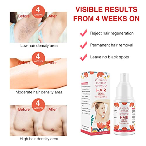 Hair Growth Inhibitor Spray, Hair Stop Growth Spray,Non-Irritating&Painless H...