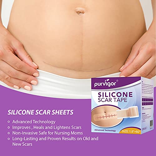 LQSM Silicone Scar Tape Roll (1.6*60inch), Sheets, Strips, Medical Grade Remo...