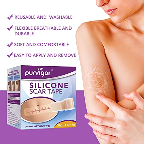 LQSM Silicone Scar Tape Roll (1.6*60inch), Sheets, Strips, Medical Grade Remo...