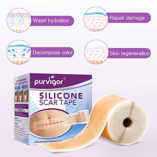 LQSM Silicone Scar Tape Roll (1.6*60inch), Sheets, Strips, Medical Grade Remo...