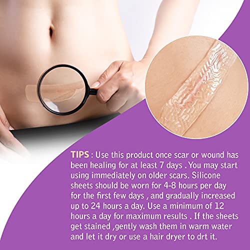 LQSM Silicone Scar Tape Roll (1.6*60inch), Sheets, Strips, Medical Grade Remo...