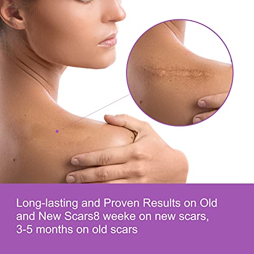 LQSM Silicone Scar Tape Roll (1.6*60inch), Sheets, Strips, Medical Grade Remo...