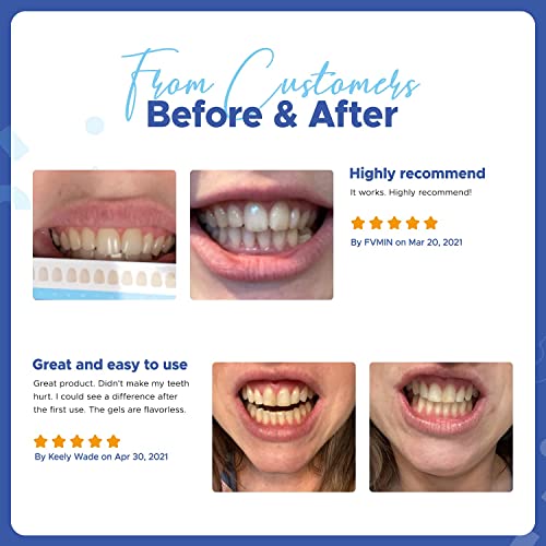 Luelli Teeth Whitening Kit with LED Light, Professional Teeth Whitening Formu...