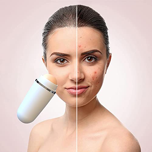 Oil-absorbing Volcanic Face Roller, Volcanic Roller Oil Control Stone, Oil-ab...