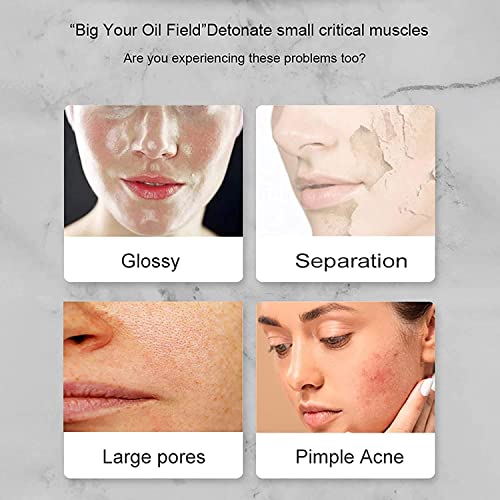 Oil-absorbing Volcanic Face Roller, Volcanic Roller Oil Control Stone, Oil-ab...