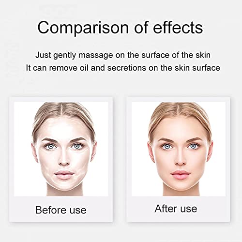 Oil-absorbing Volcanic Face Roller, Volcanic Roller Oil Control Stone, Oil-ab...