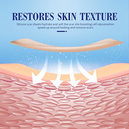 Lysam Silicone Scar Sheets, Professional Silicone Scar Tape, (1.57 x 60 inche...