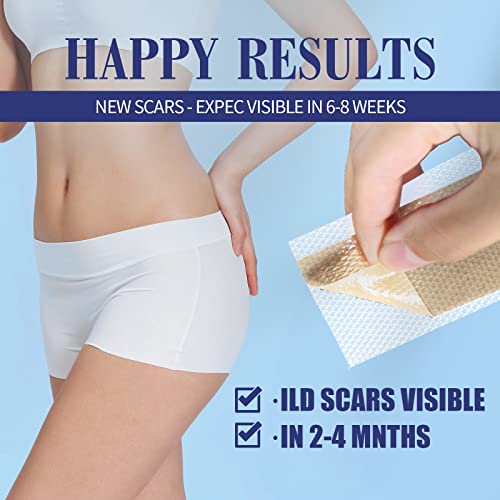 Lysam Silicone Scar Sheets, Professional Silicone Scar Tape, (1.57 x 60 inche...