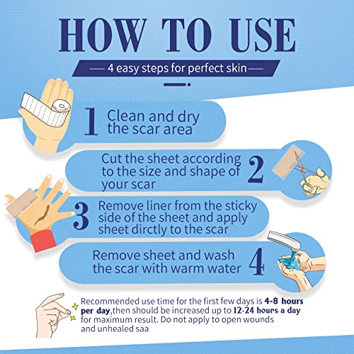 Lysam Silicone Scar Sheets, Professional Silicone Scar Tape, (1.57 x 60 inche...