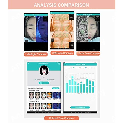 Lzour Skin Analyzer Testing,Facial Skin Analysis Equipment U-V Magnifying Lam...