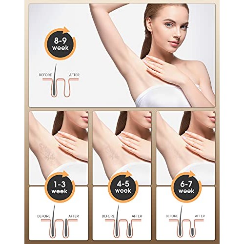 Hair Removal for Woman and Man,IPL Hair Removal Device,Permanent Painless Hai...