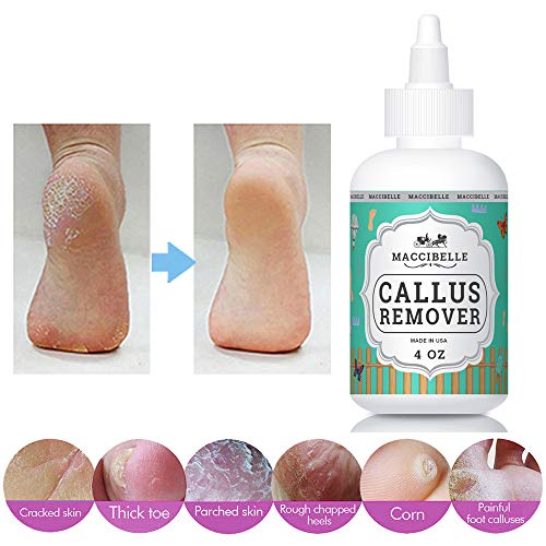 Maccibelle Callus Remover EXTRA STRENGTH For Feet, Professional Callus and Co...