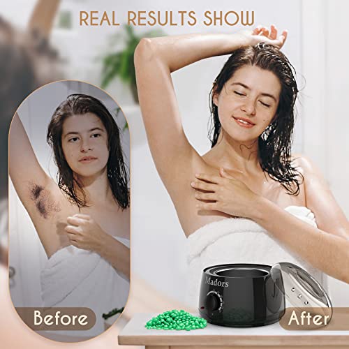 Madors Waxing Kit for Women Heating Ring Wax Warmer Wax Kit for Hair Removal ...
