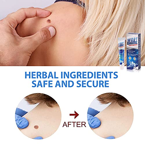 Skin Tag Remover,Wart Remover,Wart Remover Ointment,Molluscum Contagiosum Tre...