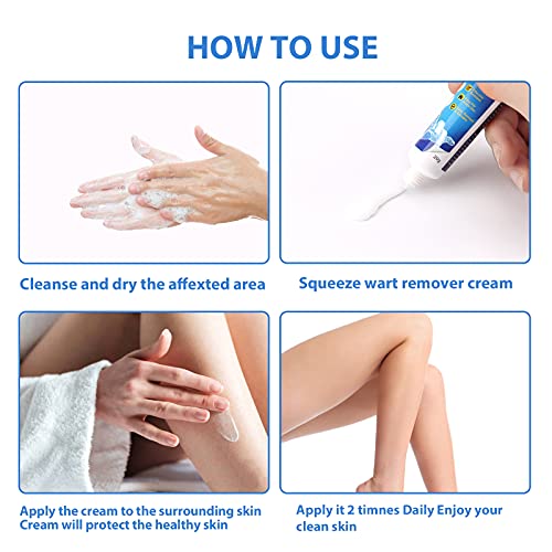 Skin Tag Remover,Wart Remover,Wart Remover Ointment,Molluscum Contagiosum Tre...