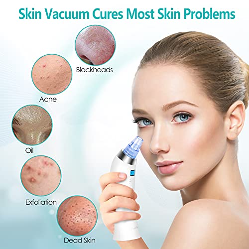 Blackhead Remover Vacuum, Electric Pore Vacuum Facial Pore Cleaner Acne Comed...