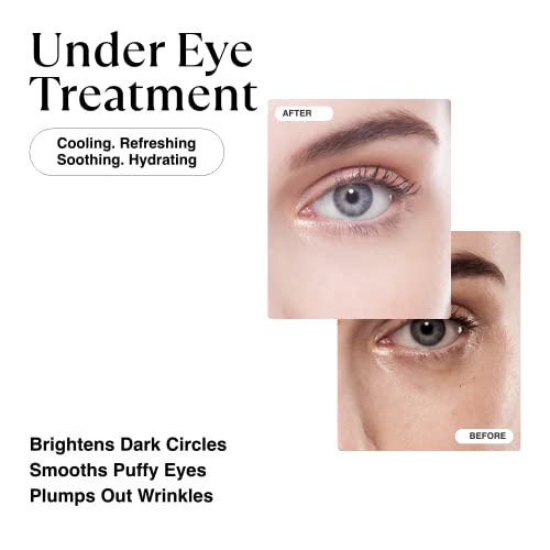 MATKAS Gold Under Eye Patches - 0.3% Pure Retinol + Hyaluronic Acid + Collage...