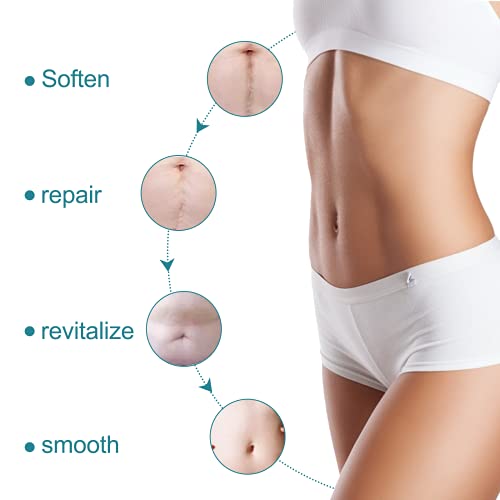 Silicone Scar Sheets, Strips, Tape - Keloid, C-Section,Soft Silicone Tape for...