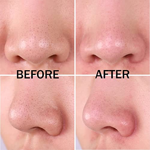 Meditime neo Pore Blackhead One Shot Pack, Blackhead Deep Cleansing, Blackhea...