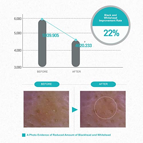 Meditime neo Pore Blackhead One Shot Pack, Blackhead Deep Cleansing, Blackhea...