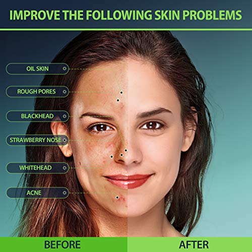 Meliza Blackhead Remover Mask, Peel Off Facial Mask 2 Packs, Charcoal Facial ...