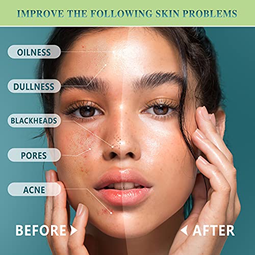 Organic Avocado Clay Mask Meliza Dead Sea Mud Mask Natural Green Tea Healing ...