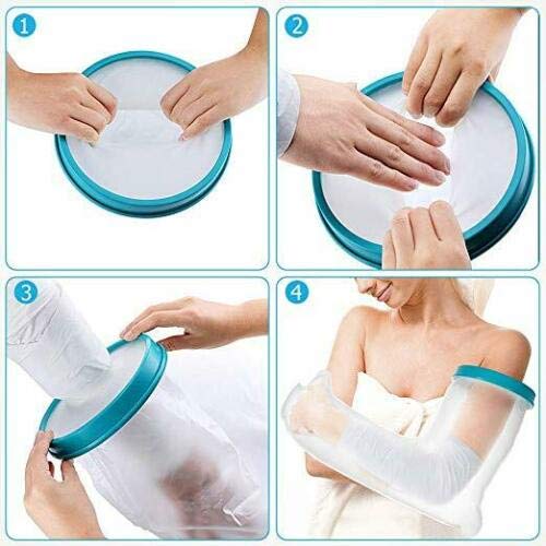 MEW Waterproof Arm Cast Cover, Kids or Adult Reusable Watertight Cast Protect...