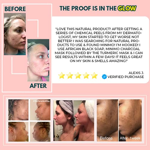 Minimo Glow Lemon Cake Skin Brightening Face Scrub for Dark Spots