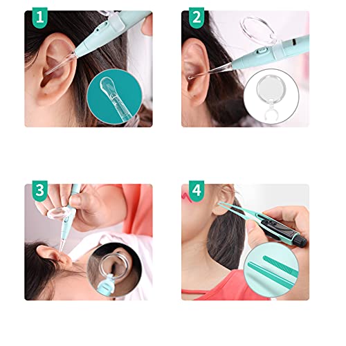 Ear Wax Removal Tool Set Mirror Flower Ear Pick Cleaner Kit with LED Light an...
