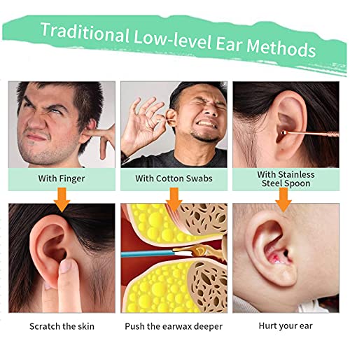 Ear Wax Removal Tool Set Mirror Flower Ear Pick Cleaner Kit with LED Light an...