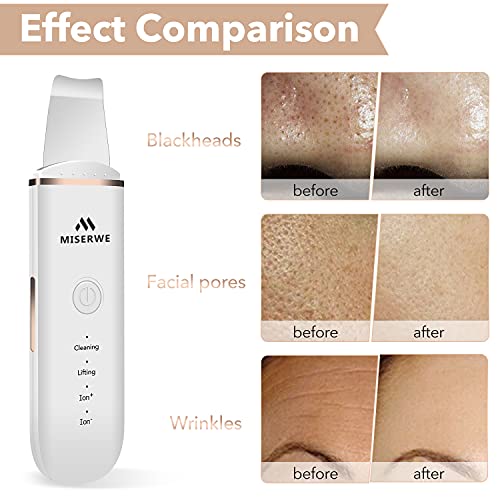 Skin Scrubber Face Skin Spatula Blackhead Remover Pore Cleaner Face Beauty Li...