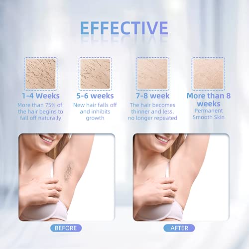 MISIFU Laser Hair Removal for Women Men Permanent with FDA Certification - Fa...