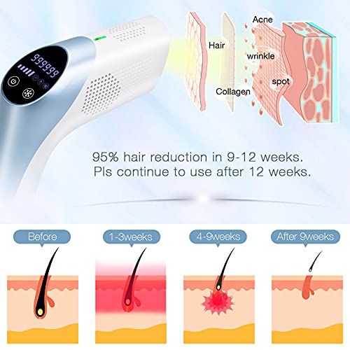 999999 Flashes MiSMON IPL Hair Removal for Women and Men, 3-in-1 Skin Care Be...