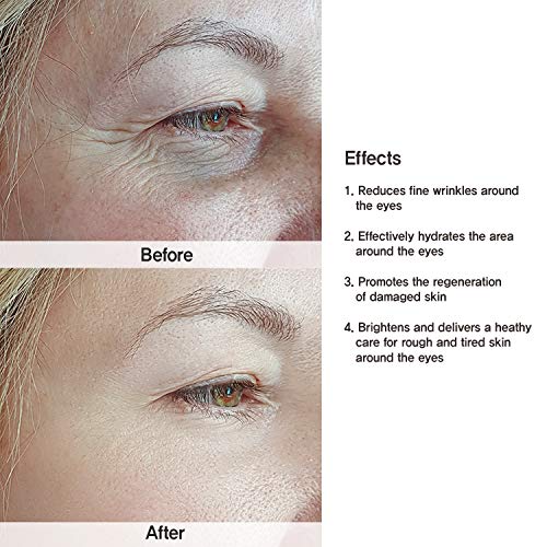 Under Eye Collagen Patches Eye Masks with 24K Gold and Snail, Eye Gel Treatme...