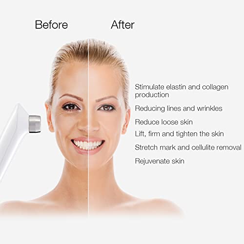 MLAY RF Radio Frequency Facial And Body Skin Tightening Machine - Professiona...