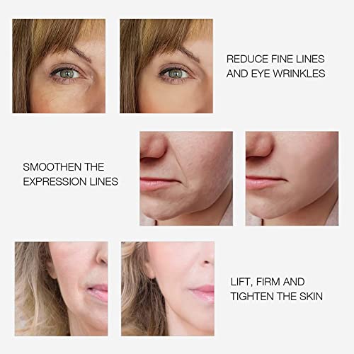 MLAY RF Radio Frequency Facial And Body Skin Tightening Machine - Professiona...