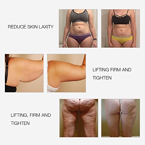 MLAY RF Radio Frequency Facial And Body Skin Tightening Machine - Professiona...