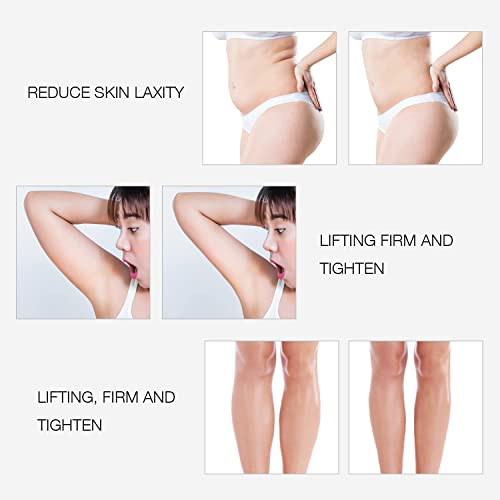 MLAY RF Radio Frequency Facial And Body Skin Tightening Machine - Professiona...
