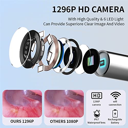 MMPANG Ear Wax Removal Camera, 1296P FHD Ear Cleaner Camera, Wireless Ear Wax...