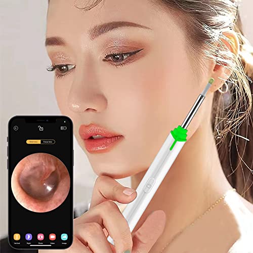 MMPANG Ear Wax Removal Camera, 1296P FHD Ear Cleaner Camera, Wireless Ear Wax...