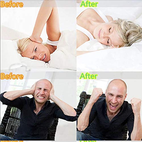 Dental Mouthguard Prevent Night Tala Tooth Teeth Bruxism Grinding Eliminating...