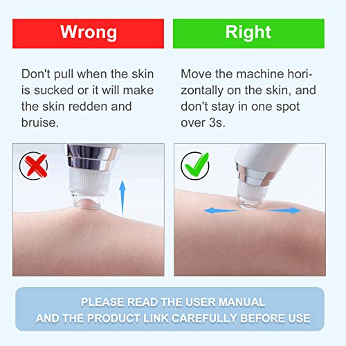 Blackhead Remover Vacuum 4-in-1 Facial Pore Cleaner USB Rechargeable Blackhea...