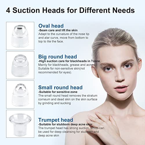 Blackhead Remover Vacuum 4-in-1 Facial Pore Cleaner USB Rechargeable Blackhea...