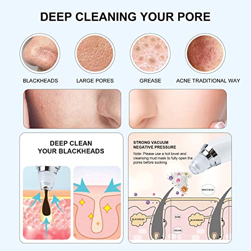 Blackhead Remover Vacuum 4-in-1 Facial Pore Cleaner USB Rechargeable Blackhea...